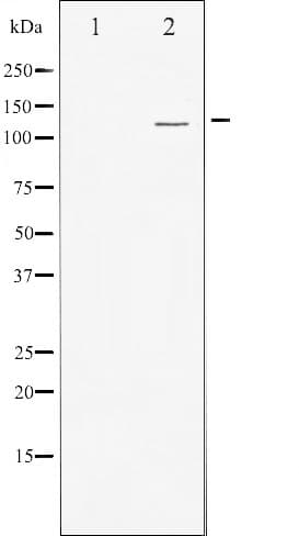 Polyclonal Rabbit anti-Human PRKD1 / PKC Mu Antibody (IF, WB)
