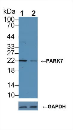 PARK7 / DJ-1 Antibody (aa1-189)