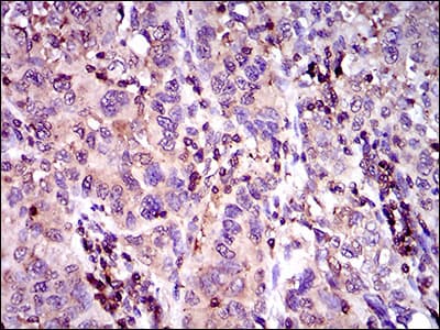 Monoclonal Mouse anti-Human ABCC4 / MRP4 Antibody (clone 2D2A9, aa631-692, IHC, WB)