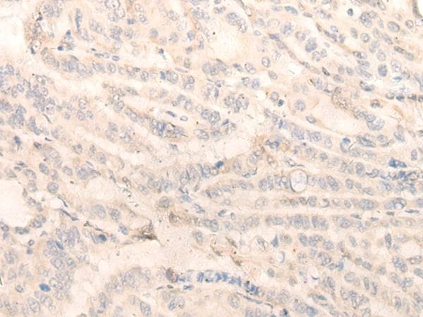 INPP1 Antibody