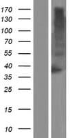 TM6SF1 Protein (Over-Expression Lysate Myc-DDK (Flag))