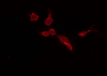 Polyclonal Rabbit anti-Human USP45 Antibody (IF, WB)