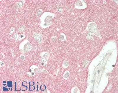 IHC-plus™ Polyclonal Rabbit anti-Human Neurofascin / NF Antibody (IHC, WB)