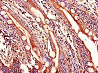 Polyclonal Rabbit anti-Human WNT1 Antibody (IHC)