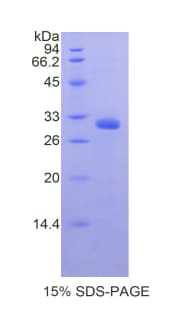 Mouse MYO1A Protein (Recombinant His)
