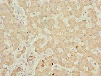 Polyclonal Rabbit anti-Human IWS1 Antibody (IHC)