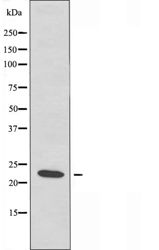 SARA2 / SAR1B Antibody