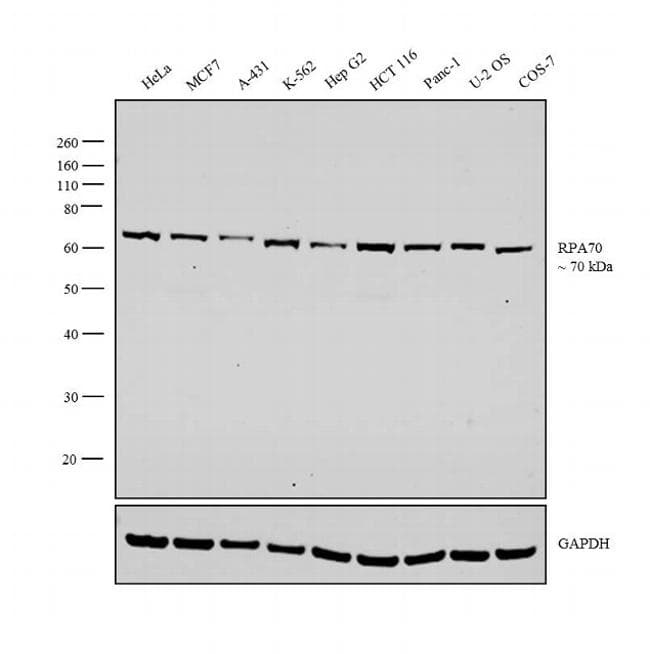 RPA70 / RPA1 Antibody (clone 4C4)