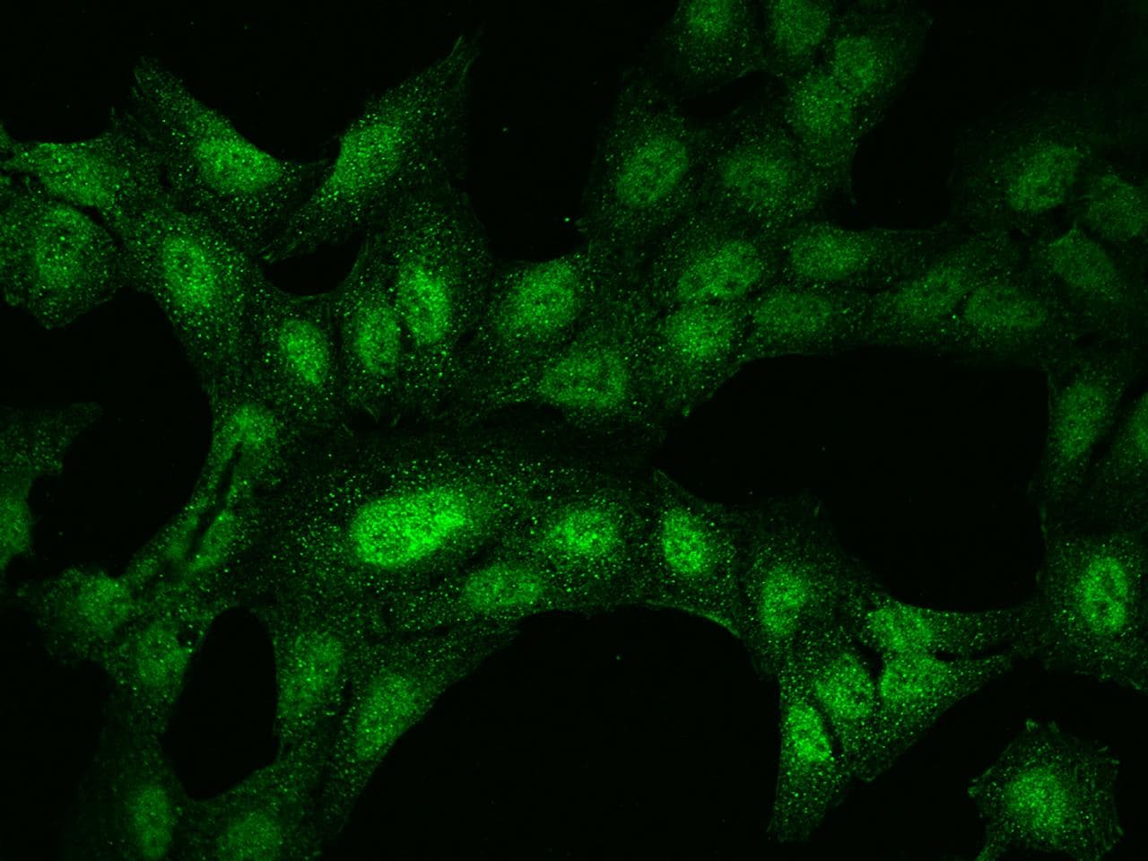 Polyclonal Rabbit anti-Human LCX / TET1 Antibody (IF)