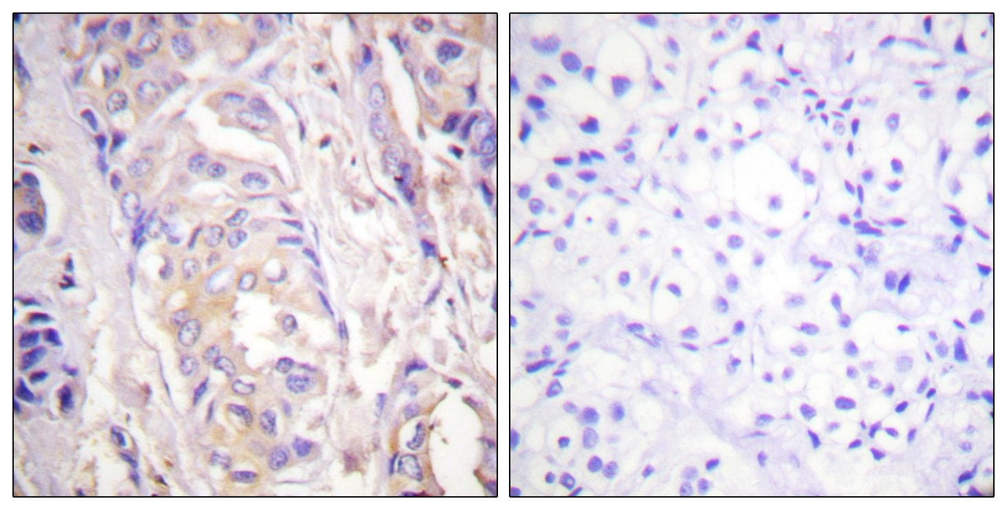 Polyclonal Rabbit anti-Human MAP2K1 / MKK1 / MEK1 Antibody (p286, IHC, WB)