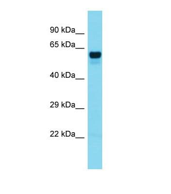 Polyclonal Rabbit anti-Human FOXO6 Antibody (aa91-140, WB)