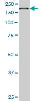 EIF4G1 / EIF4G Antibody (clone 3A10)