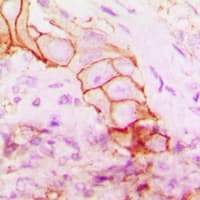 Polyclonal Rabbit anti-Human ITGB4 / Integrin Beta 4 Antibody (C-Terminus, IHC, WB)
