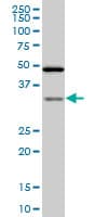 IHC-plus™ TARBP2 / TRBP2 Antibody (clone 2G10)