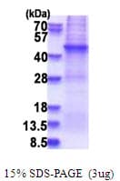 Human AFAP1 / AFAP Protein (Recombinant His)
