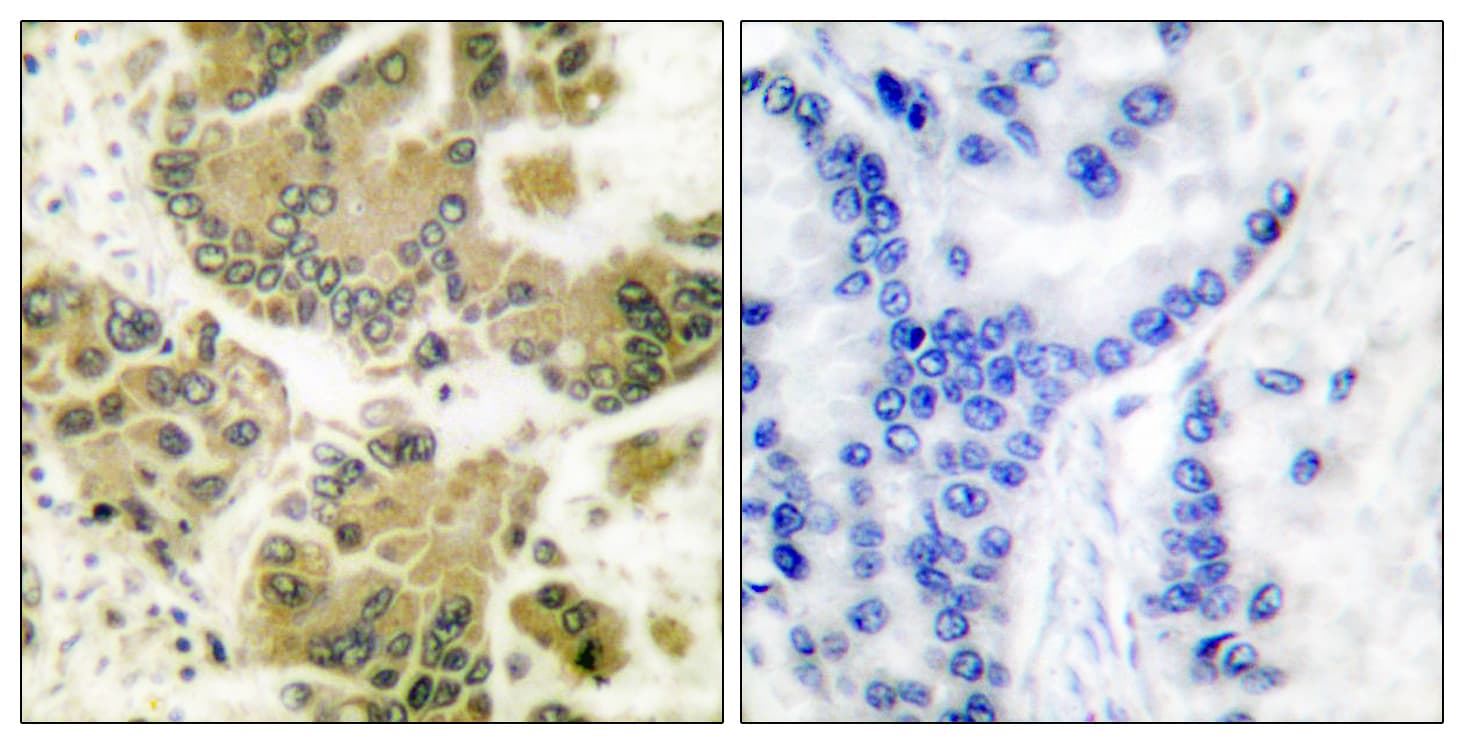 Polyclonal Rabbit anti-Human SGK1 / SGK Antibody (aa381-430, IHC, WB)