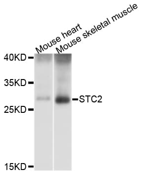 Polyclonal Rabbit anti-Human STC2 / Stanniocalcin 2 Antibody (WB)