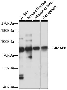 Polyclonal Rabbit anti-Human GIMAP8 Antibody (WB)