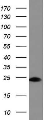 Monoclonal Mouse anti-Human BID Antibody (clone UMAB139, IHC, WB)
