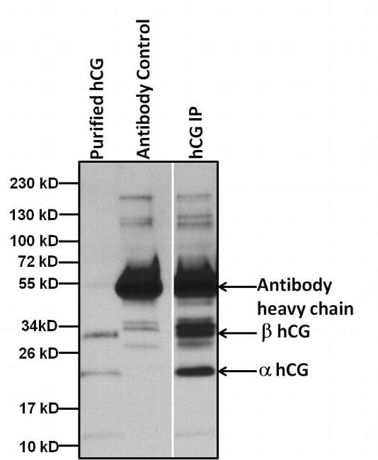 Monoclonal Mouse anti-Human hCG / Chorionic Gonadotropin Antibody (clone SC2, WB)