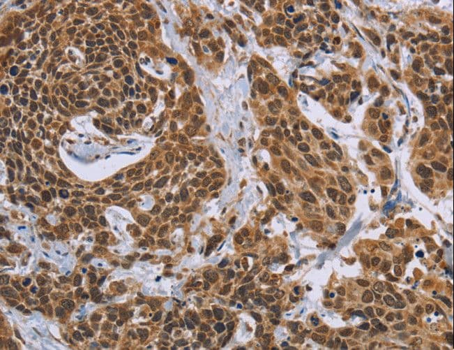 CCL21 / SLC Antibody
