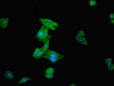SENP2 Antibody