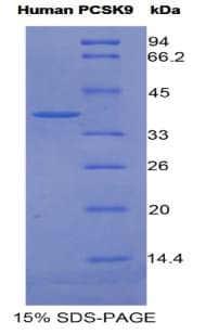 Human PCSK9 Protein (Recombinant His)
