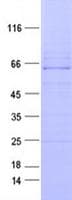 Human PDGFRB / PDGFR Beta Protein (Recombinant DDK,C-terminus)