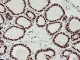 GOLM1 / GP73 / GOLPH2 Antibody (clone OTI4B12)