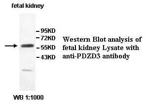 IHC-plus™ Polyclonal Rabbit anti-Human PDZD3 Antibody (aa119-435, IHC, WB)