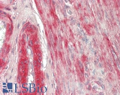 IHC-plus™ VTI1B Antibody