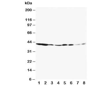 Polyclonal Rabbit anti-Human MAPK3 / ERK1 Antibody (aa287-301, IHC, WB)