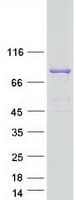 Human SEC23B Protein (Recombinant Myc-DDK (Flag))