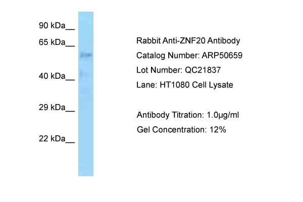 Polyclonal Rabbit anti-Human ZNF20 Antibody (aa449-498, WB)