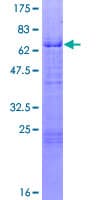 Human KLF3 Protein (Recombinant GST)