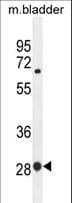 Polyclonal Rabbit anti-Human BTF3 Antibody (aa1-30, WB)