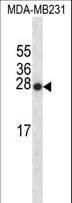 SNX24 Antibody (aa86-113)