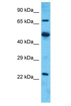 MARCH7 / Axotrophin Antibody (aa20-69)