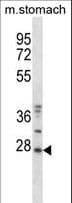PRPK / TP53RK Antibody (aa100-128)