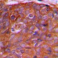 PEX2 / PAF-1 Antibody (N-Terminus)