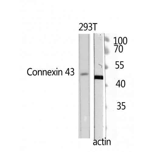 DCX / Doublecortin Antibody (180-260 aa)