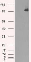 Monoclonal Mouse anti-Human BUB1B / BubR1 Antibody (clone OTI6E5, IHC, IF, WB)