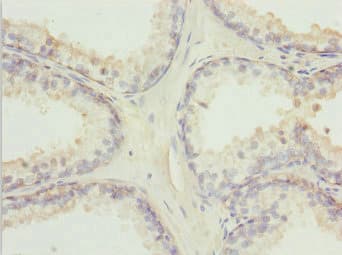 TM9SF1 Antibody