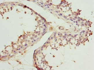BBS2 / BBS Antibody