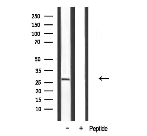 SPIC Antibody