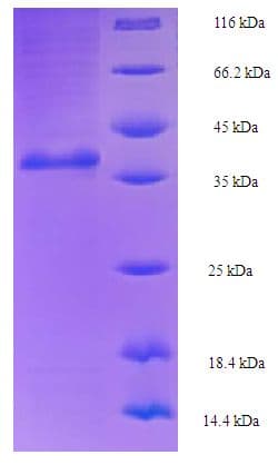 Saccharomyces cerevisiae Ran GTPase GSP1 Protein (Recombinant His-SUMO)