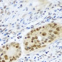 PSMB2 Antibody