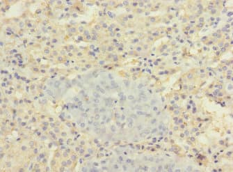 SLC22A8 / OAT3 Antibody