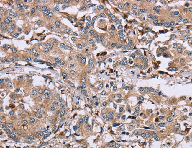 MAGEA3 Antibody