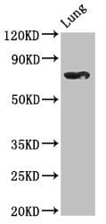 Polyclonal Rabbit anti-Human TBX2 Antibody (WB)